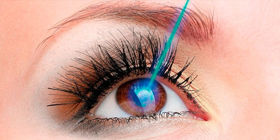 Cirurgia refrativa (miopia hipermetropia e astigmatismo)